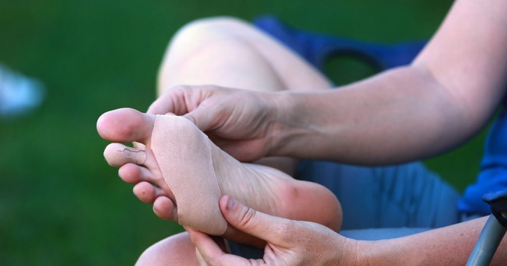 Blisters and chafing on the feet: cured and prevented?